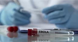 Rritet numri i rasteve me Ebola në Kongo, shkon në mbi një mijë numri i të prekurve Rritet numri i rasteve me Ebola në Kongo, shkon në mbi një mijë numri i të prekurve