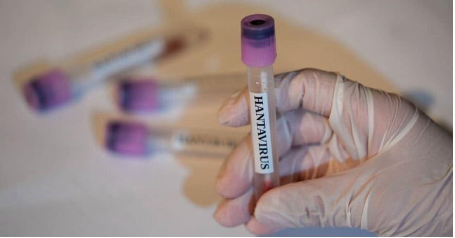 12 punonjës spitali izolohen pas një procedure të gabuar në trajtimin e një pacienti me hantavirus 12 punonjës spitali izolohen pas një procedure të gabuar në trajtimin e një pacienti me hantavirus