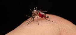 Regjistrohet rasti i parë me virusin Zika në Maqedoni, pacienti u infektua sa ishte për pushime në Maldive Regjistrohet rasti i parë me virusin Zika në Maqedoni, pacienti u infektua sa ishte për pushime në Maldive