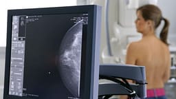 Revolucion në onkologji: Kimioterapia mund të shmanget në dy të tretat e rasteve Revolucion në onkologji: Kimioterapia mund të shmanget në dy të tretat e rasteve