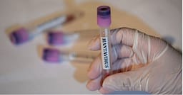 12 punonjës spitali izolohen pas një procedure të gabuar në trajtimin e një pacienti me hantavirus 12 punonjës spitali izolohen pas një procedure të gabuar në trajtimin e një pacienti me hantavirus
