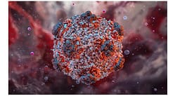 Ku u infektua me hantavirus “pacienti zero”? Ku u infektua me hantavirus “pacienti zero”?