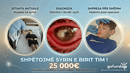 Kërkohet ndihmë për trajtimin e Ardit Muqakut, 9-vjeçari po përballet me një betejë të rëndë për shikimin Kërkohet ndihmë për trajtimin e Ardit Muqakut, 9-vjeçari po përballet me një betejë të rëndë për shikimin