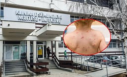 IKSHPK: Për një muaj janë konfirmuar 14 raste të fruthit, vaksinoni fëmijët – rreziku për komplikime është serioz IKSHPK: Për një muaj janë konfirmuar 14 raste të fruthit, vaksinoni fëmijët – rreziku për komplikime është serioz