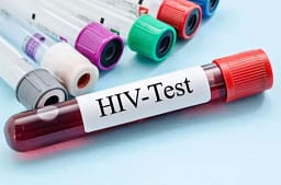 Dhjetë raste të reja me HIV në muajt e fundit, dy viktima – rritet testimi vullnetar Dhjetë raste të reja me HIV në muajt e fundit, dy viktima – rritet testimi vullnetar
