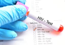 10 raste të reja me HIV në muajt e fundit, 2 viktima e 2 në spital, rritet testimi vullnetar 10 raste të reja me HIV në muajt e fundit, 2 viktima e 2 në spital, rritet testimi vullnetar
